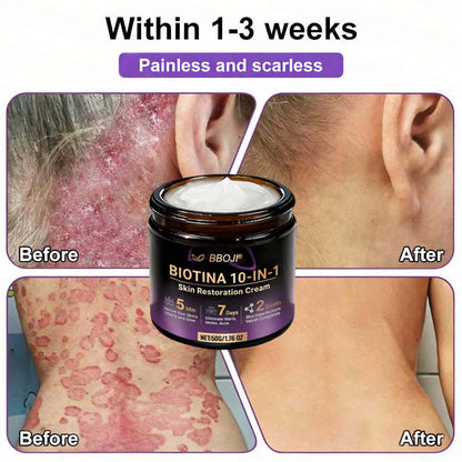 Product shipped from the USA ✨ 𝐁𝐁𝑶𝑱𝑰® 𝘽𝙞𝙤𝒕𝒊𝒏 10--𝘪𝘯-1 𝘚𝘬𝘪𝘯 𝘙𝘦𝘴𝘵𝘰𝘳𝘢𝘵𝘪𝑜𝑛 𝐶𝑟𝑒𝑎𝑚 🍀