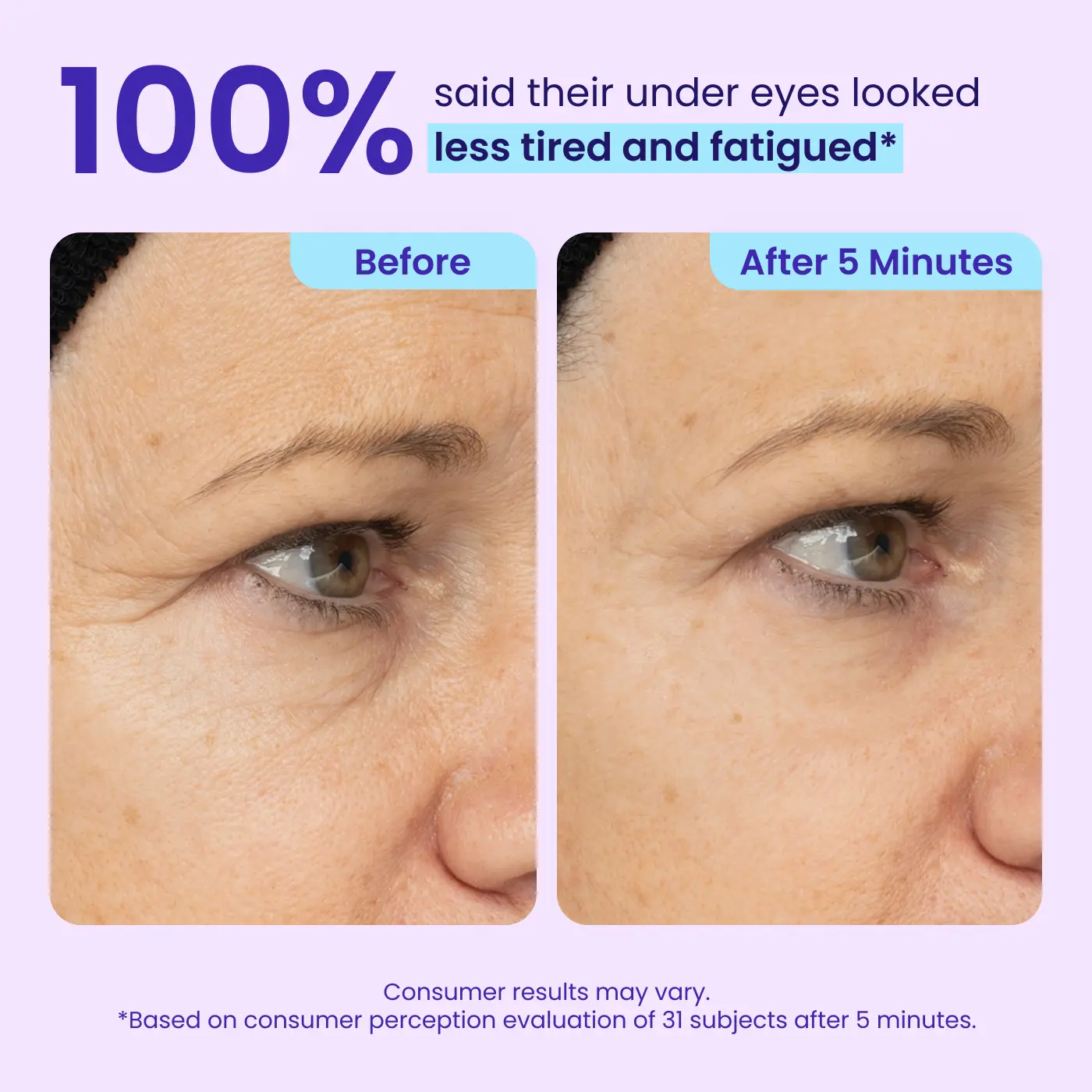Instant Lift Eye Gel — Reduce the Look of Eye Bags in Minutes