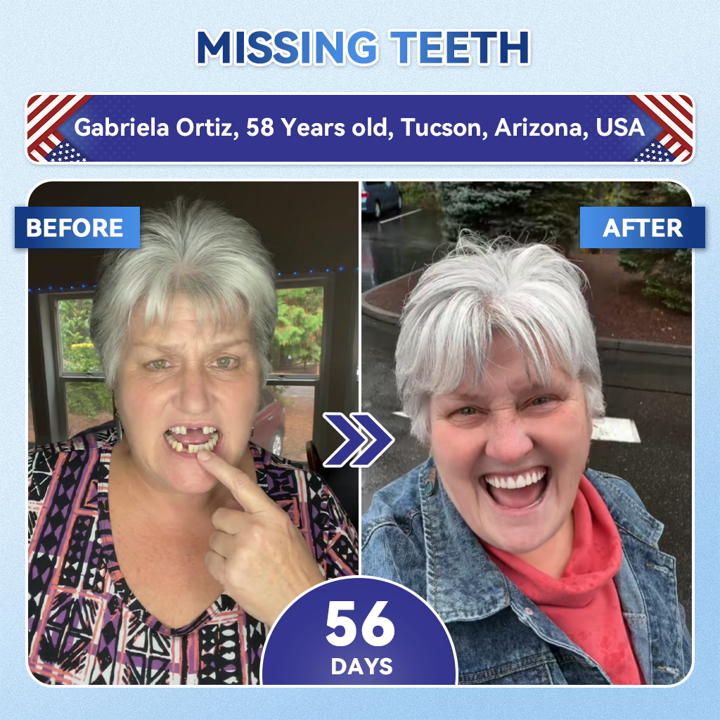 ✨𝑨𝒍𝒊𝒔𝒂𝒏𝙙𝙖®🦷 𝙏𝙞𝒅𝒆𝒈𝒍𝒖𝒔𝒊𝒃 𝑭𝒂𝙨𝙩‑𝘿𝙞𝙨𝙨𝙤𝙡𝙫𝙞𝙣𝙜 𝙏𝙤𝙤𝙩𝙝 & 𝙂𝙪𝒎 𝑹𝒆𝒑𝒂𝒊𝒓 𝑶𝒓𝒂𝙡 𝙎𝙩𝒓𝒊𝒑𝒔
