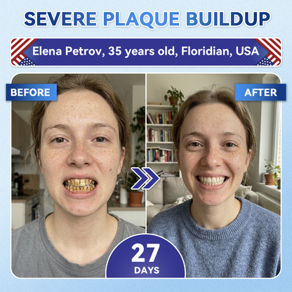 ✨𝑨𝒍𝒊𝒔𝒂𝒏𝙙𝙖®🦷 𝙏𝙞𝒅𝒆𝒈𝒍𝒖𝒔𝒊𝒃 𝑭𝒂𝙨𝙩‑𝘿𝙞𝙨𝙨𝙤𝙡𝙫𝙞𝙣𝙜 𝙏𝙤𝙤𝙩𝙝 & 𝙂𝙪𝒎 𝑹𝒆𝒑𝒂𝒊𝒓 𝑶𝒓𝒂𝙡 𝙎𝙩𝒓𝒊𝒑𝒔