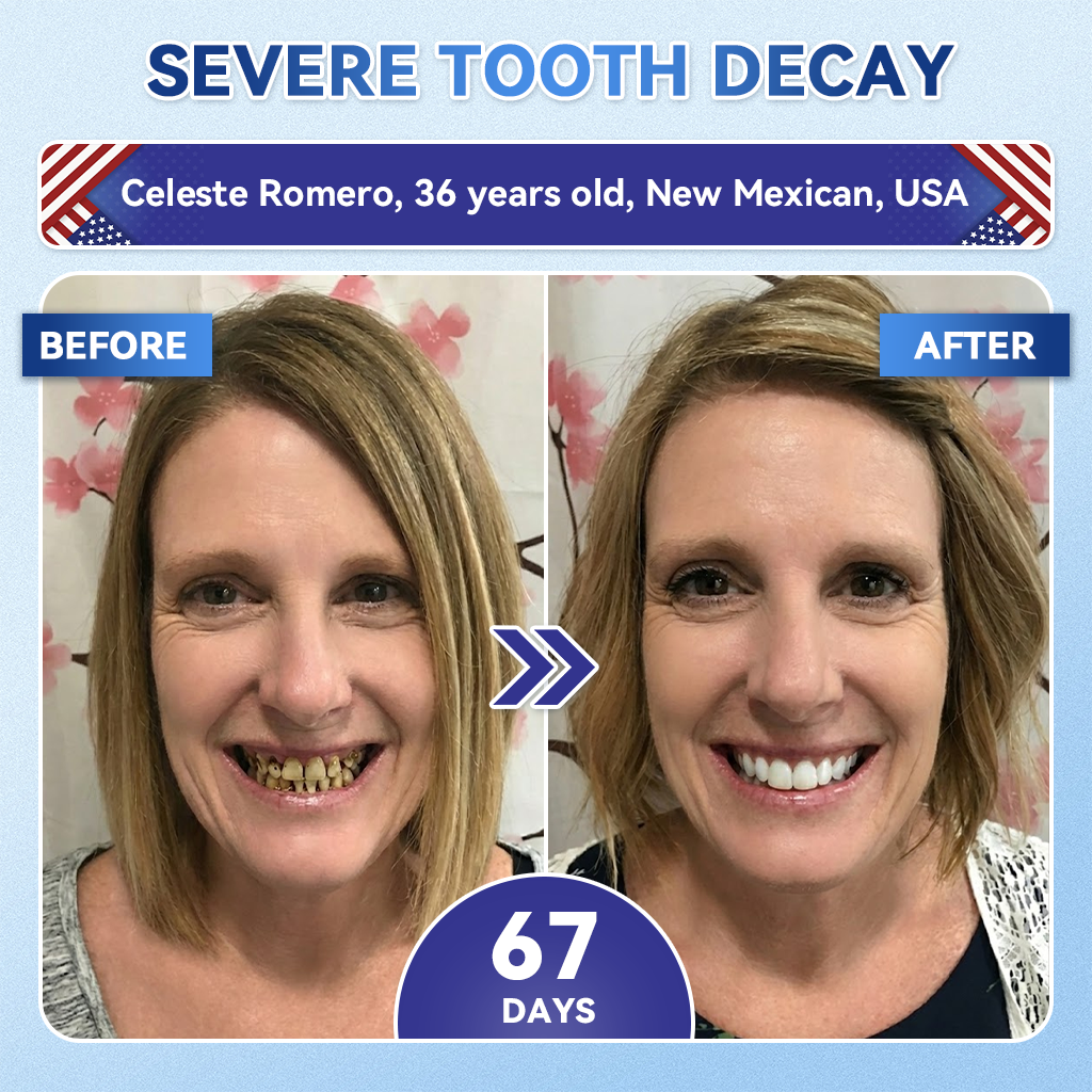 ✨𝑨𝒍𝒊𝒔𝒂𝒏𝙙𝙖®🦷 𝙏𝙞𝒅𝒆𝒈𝒍𝒖𝒔𝒊𝒃 𝑭𝒂𝙨𝙩‑𝘿𝙞𝙨𝙨𝙤𝙡𝙫𝙞𝙣𝙜 𝙏𝙤𝙤𝙩𝙝 & 𝙂𝙪𝒎 𝑹𝒆𝒑𝒂𝒊𝒓 𝑶𝒓𝒂𝙡 𝙎𝙩𝒓𝒊𝒑𝒔